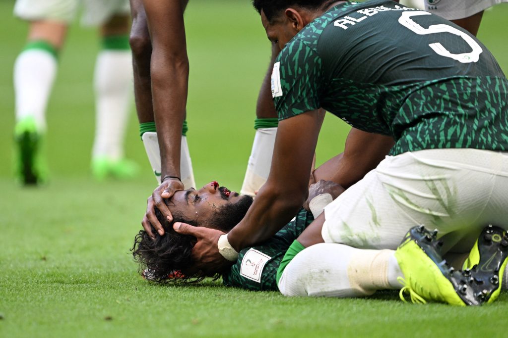 Lateral da Arábia Saudita levou a pior na jogada (Foto: Akirill Kudryavtsev/AFP)
