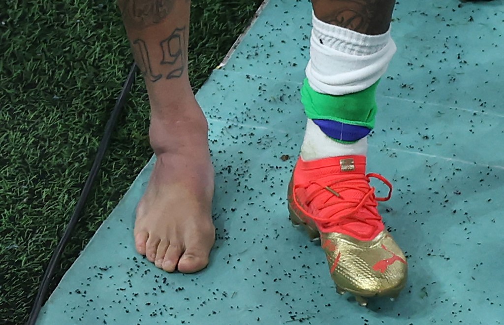 Neymar sofreu entorse no tornozelo durante a partida