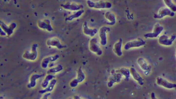 ameba comedora de cérebro