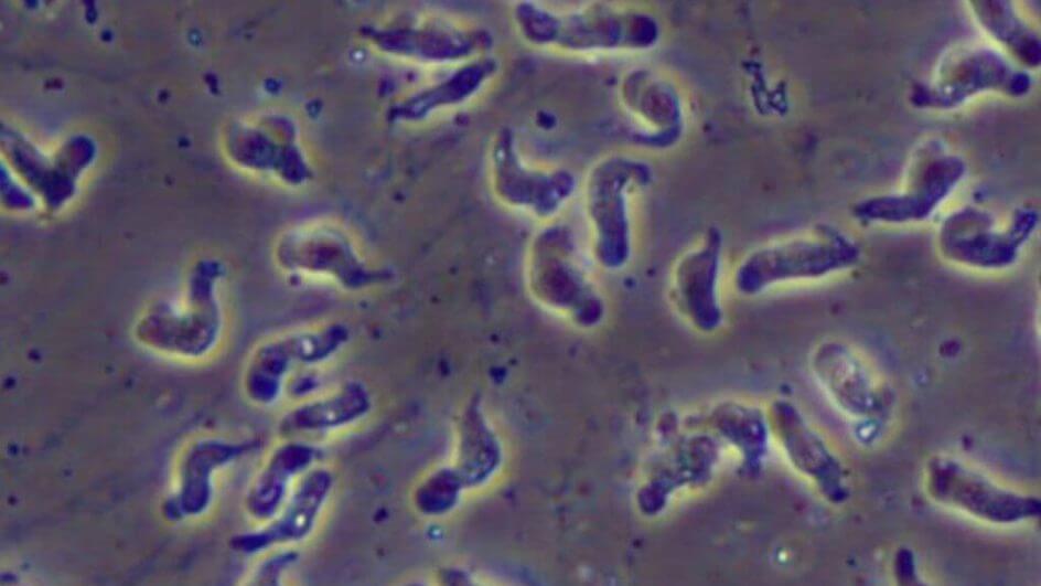 ameba comedora de cérebro