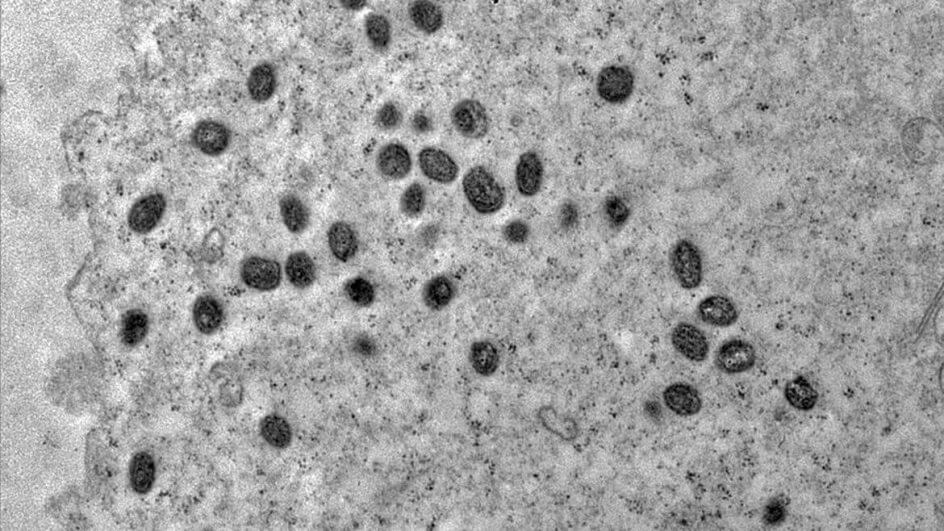 mpox