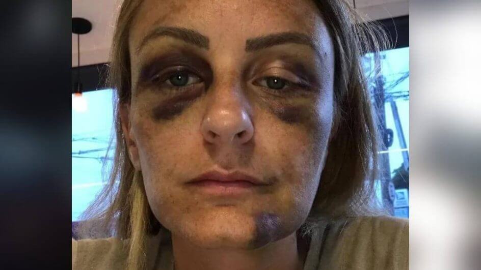 Ela conta que agressão fez com que o relacionamento terminasse (Foto: Reprodução/Redes sociais)