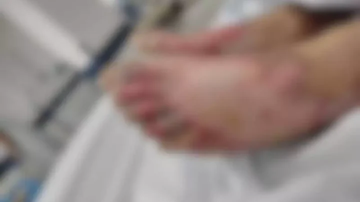 Menino sofreu queimaduras de terceiro grau nos pés e em outras partes do corpo