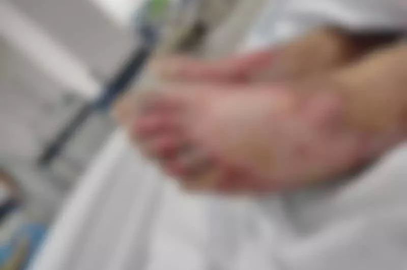 Menino sofreu queimaduras de terceiro grau nos pés e em outras partes do corpo