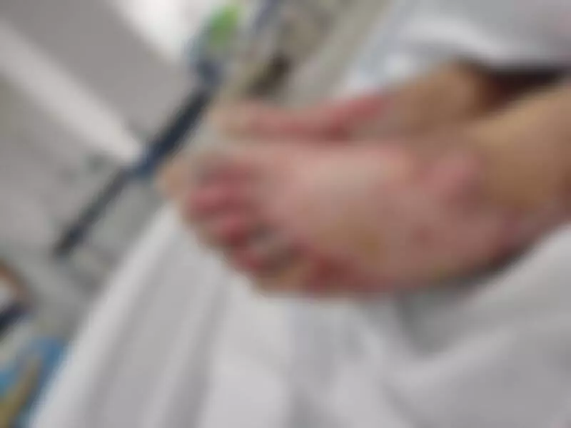 Menino sofreu queimaduras de terceiro grau nos pés e em outras partes do corpo