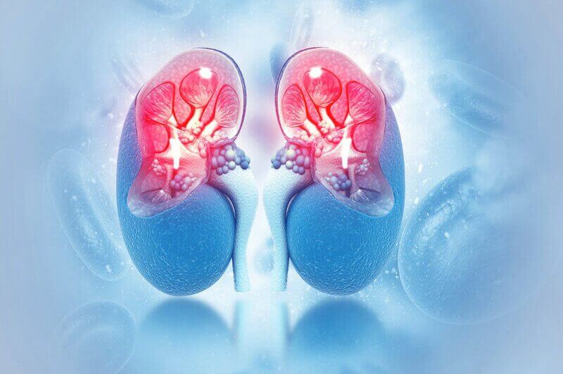 Ilustração de um rim com pedras