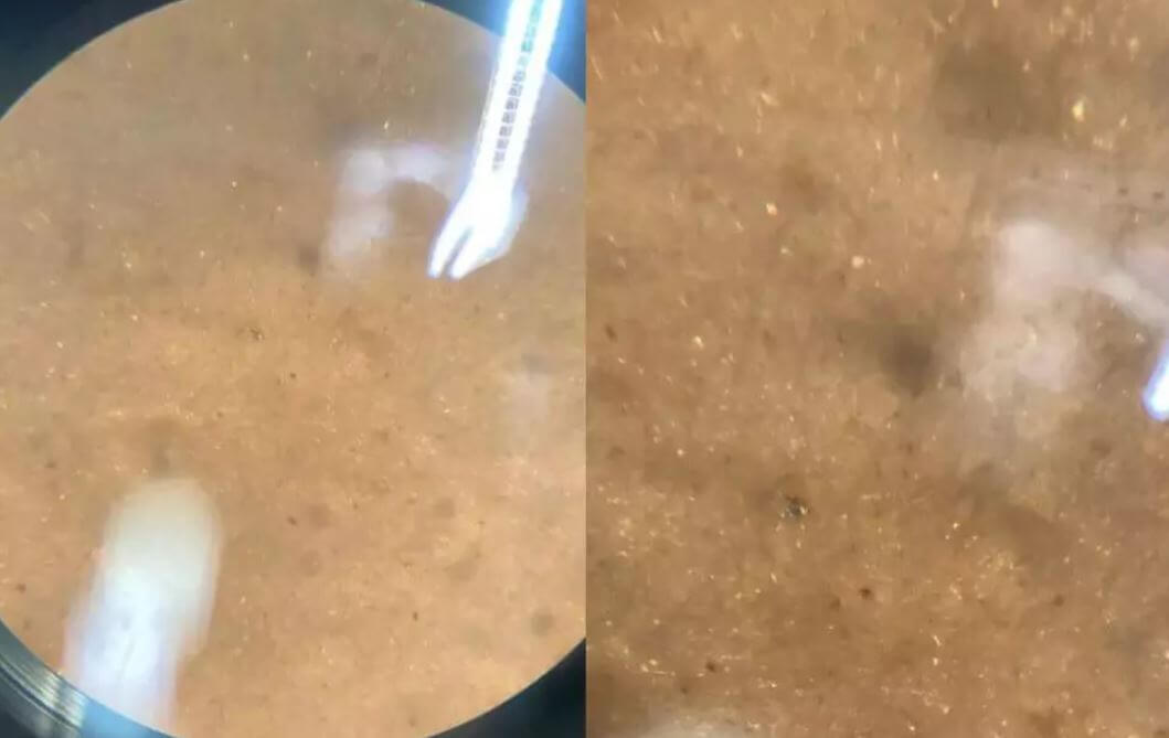 Estudo revela glitter e até microplásticos em mariscos de SC