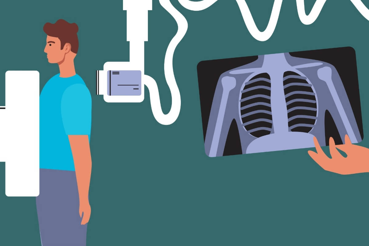 Ilustração de um homem fazendo tomografia no tórax