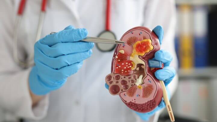 Médico apontando para rim demonstrativo
