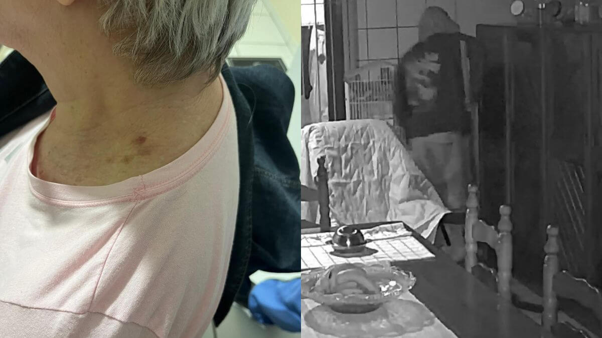 Idosa é agredida com pedaço de madeira durante assalto em Tijucas