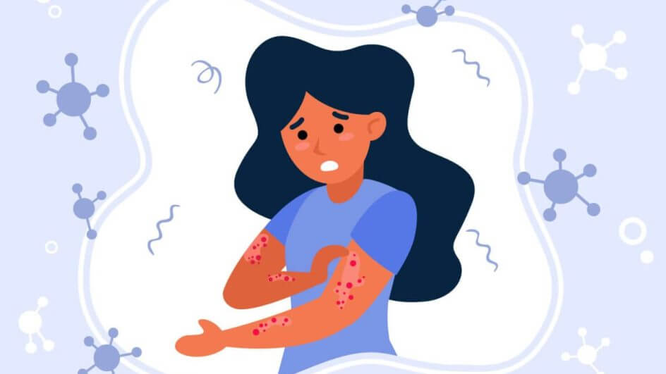 Ilustração de uma mulher olhando o braço com manchas