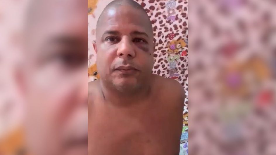 Marcelinho Carioca aparece em vídeo com uma marca de agressão no rosto (Foto: Reprodução)