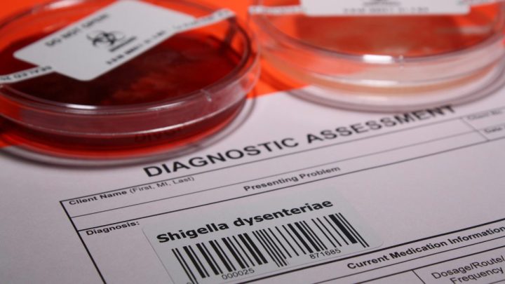 Shigella