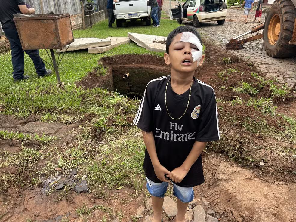 Menino cai em bueiro e é arrastado por 300 metros de tubulação durante chuva: "muita água"