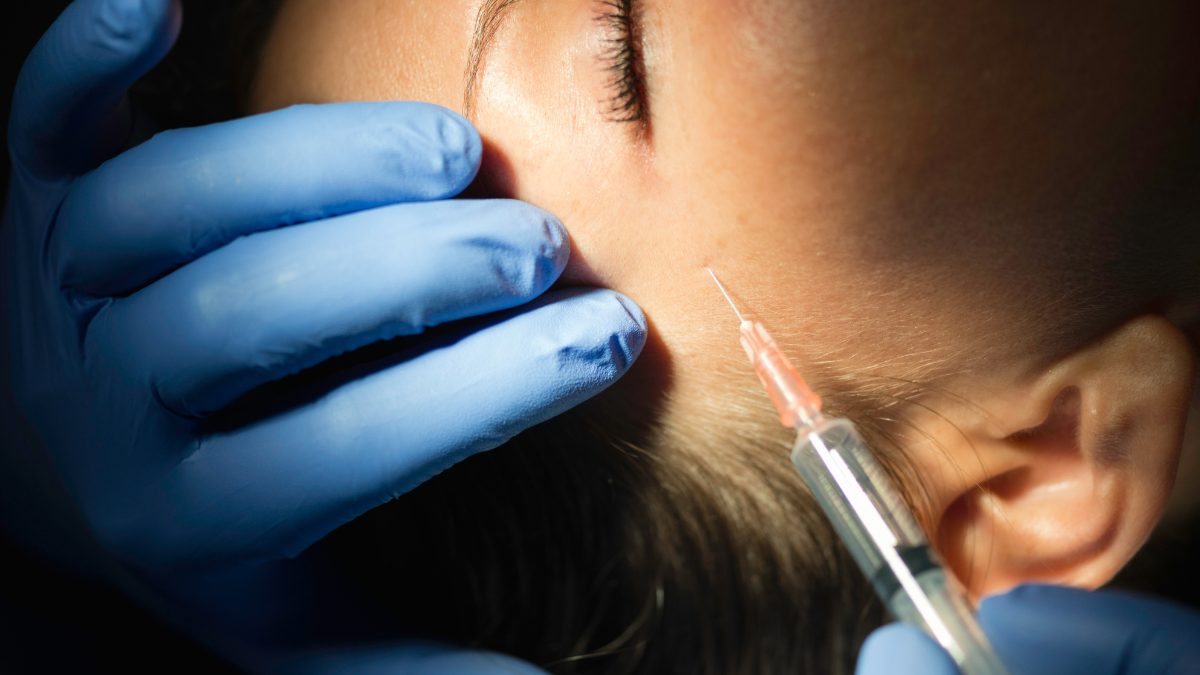 Botox funciona