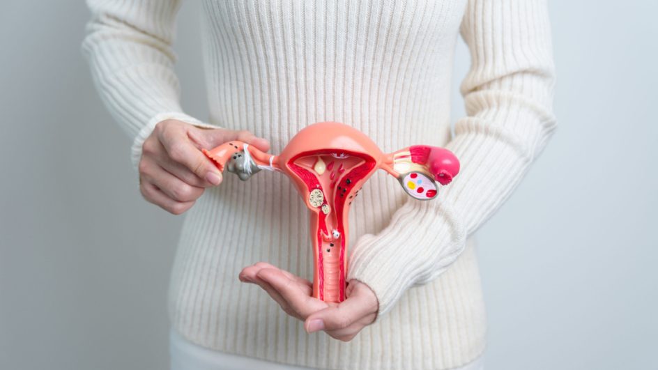 Ao receber o diagnóstico ultrassonográfico de miomas uterinos, o tratamento deve ser iniciado o mais breve possível (Imagem: Jo Panuwat D | Shutterstock)
