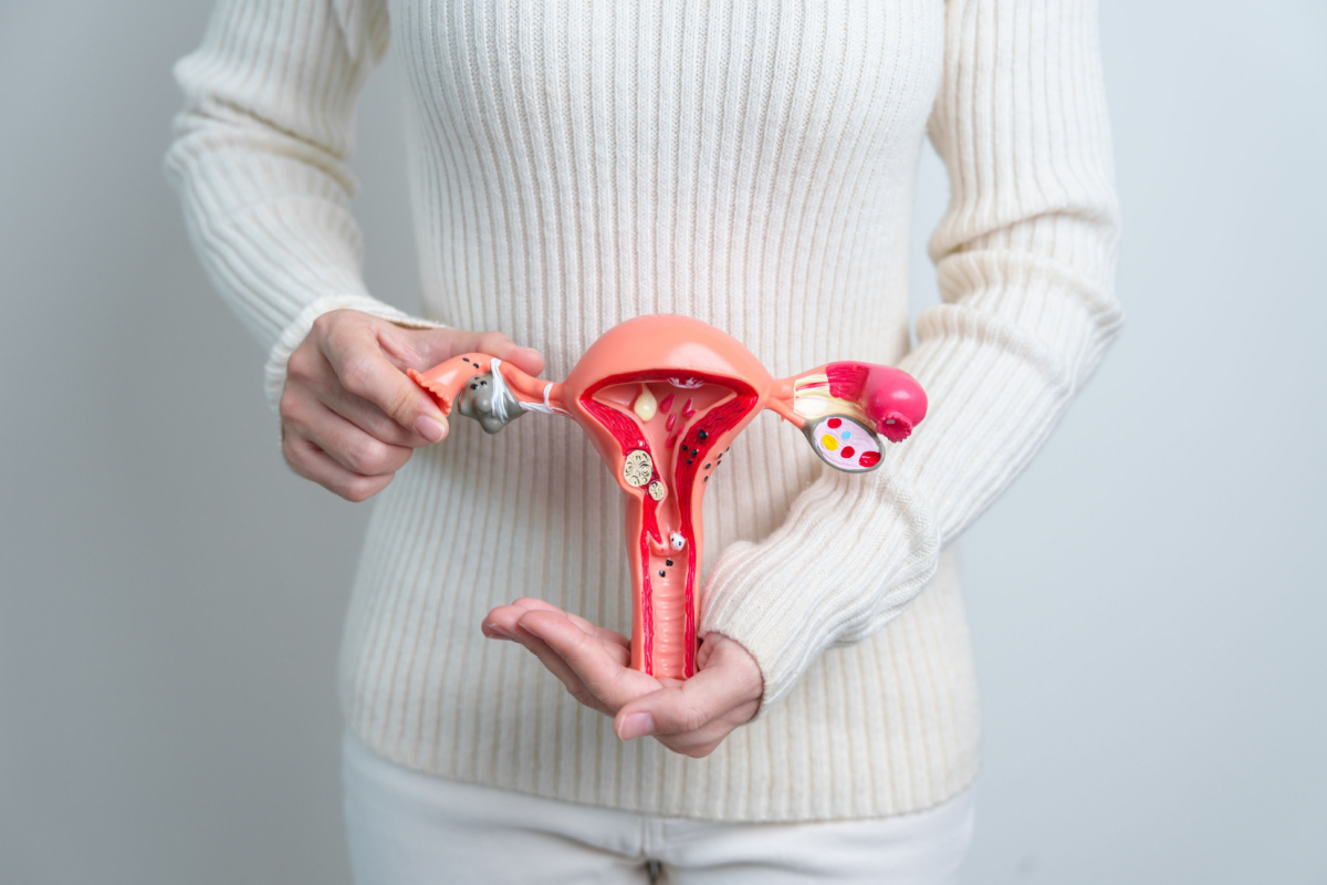 Ao receber o diagnóstico ultrassonográfico de miomas uterinos, o tratamento deve ser iniciado o mais breve possível (Imagem: Jo Panuwat D | Shutterstock)