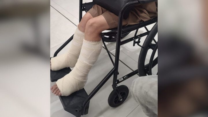 Idosa quebra tornozelos e deve passar por cirurgia após pneu de ônibus estourar em Florianópolis