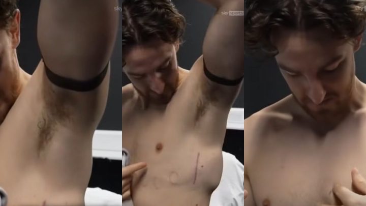 Jogador que sofreu parada cardíaca quer voltar aos campos usando um desfibrilador implantável (1)