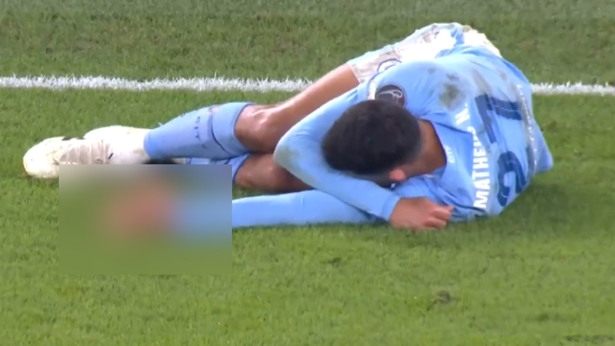 Jogador sofre lesão impressionante em partida da Champions League Manchester City Matheus Nunes