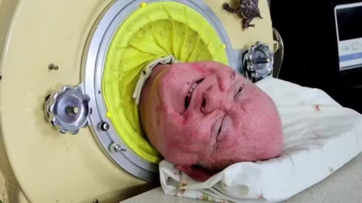 Quem era o homem do pulmão de ferro que viveu 70 anos dentro de cilindro de metal