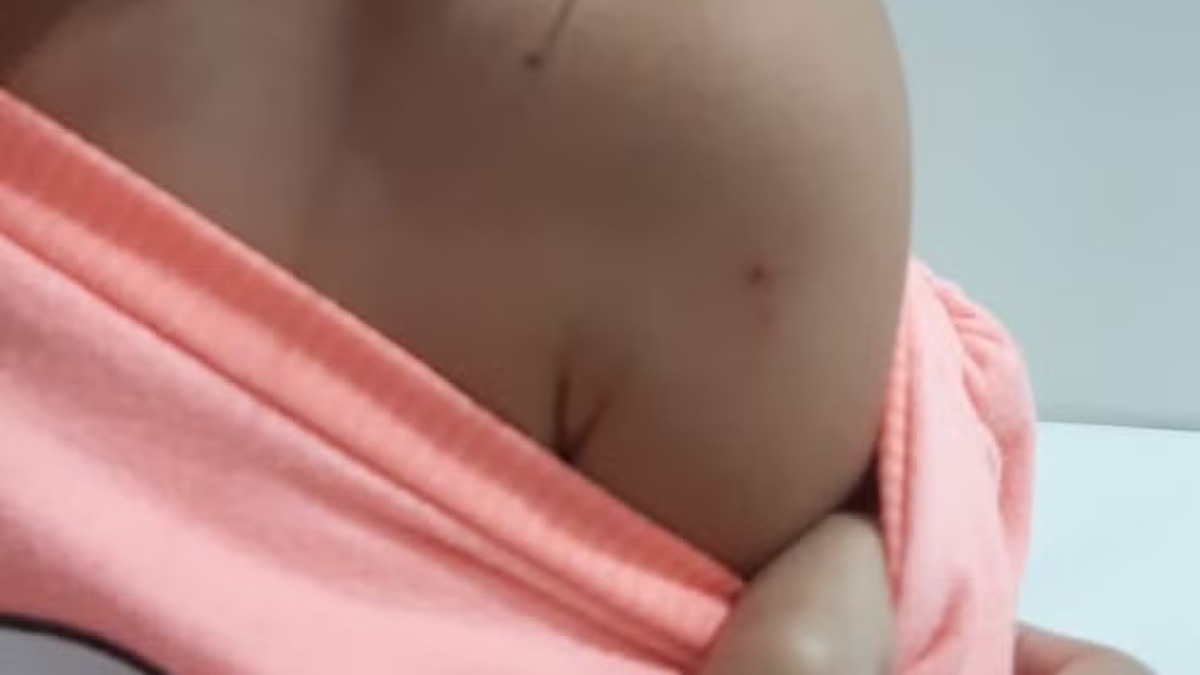 UPA onde menina foi picada "acidentalmente" por agulha j&aacute; foi alvo do MP por neglig&ecirc;ncia em SC