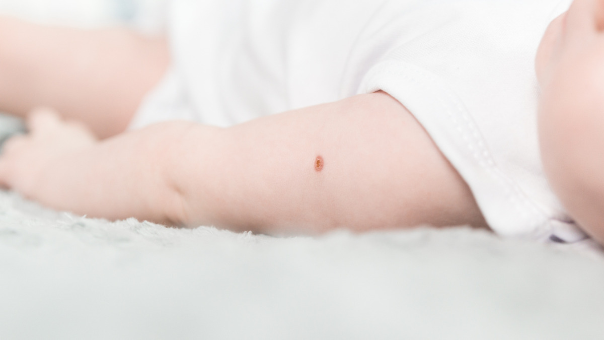 vacinas para crianças