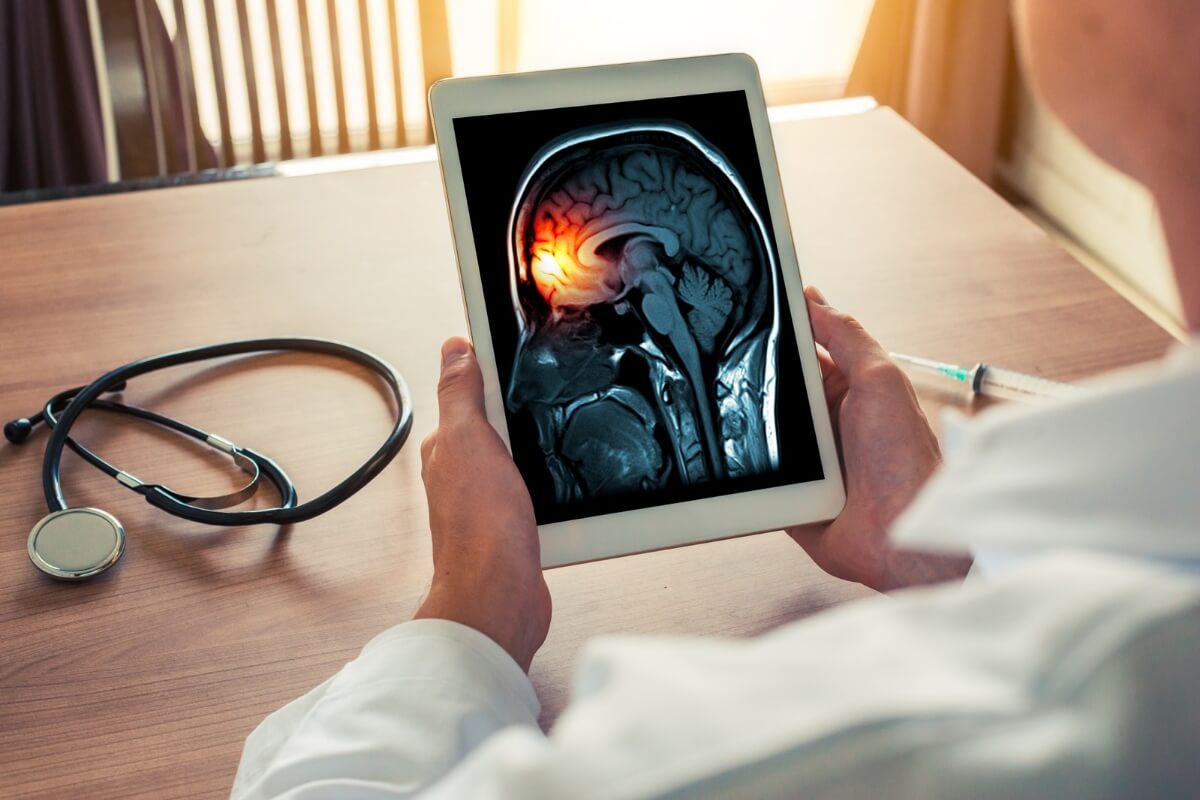 Meningite é um problema grave de saúde pública (Imagem:steph photographies | Shutterstock)