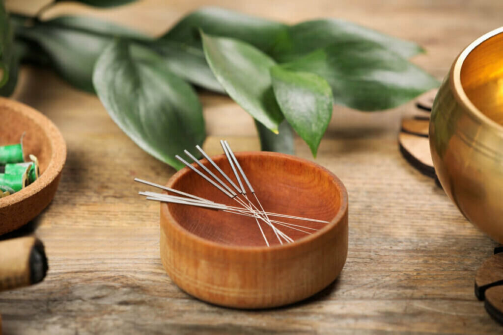 A acupuntura não só controla a dor, mas também melhora o humor e o sono (Imagem: New Africa | Shutterstock)