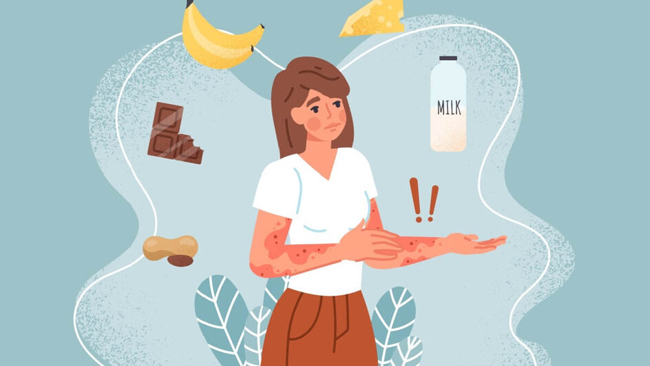 A alergia alimentar é uma condição grave que merece cuidado (Imagem: Liana Nagieva | Shutterstock)