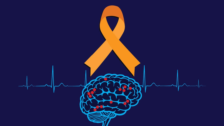 A esclerose múltipla é uma doença neurológica crônica (Imagem: MURGROUP || Shutterstock)