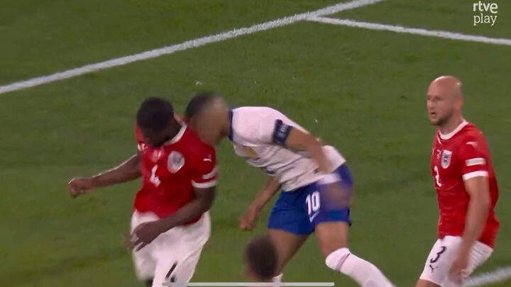 VÍDEO Mbappé quebra nariz em estreia na Eurocopa