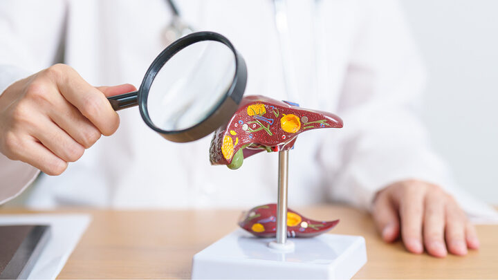 hepatites