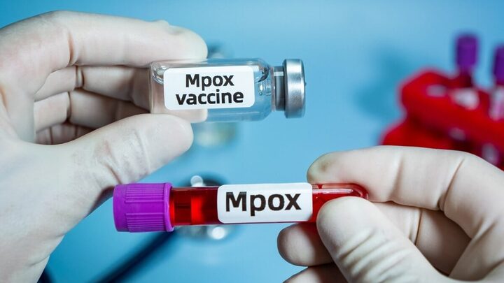 Dúvidas sobre a Mpox cresceram após a declaração de emergência de saúde pública pela OMS (Imagem: QINQIE99 | Shutterstock)