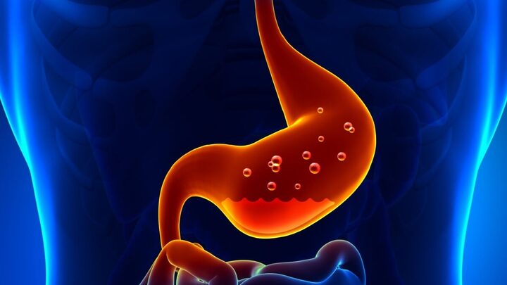Carboidratos podem influenciar o refluxo gastroesofágico, dependendo de como e quais tipos são consumidos (Imagem: decade3d - anatomy online | Shutterstock)