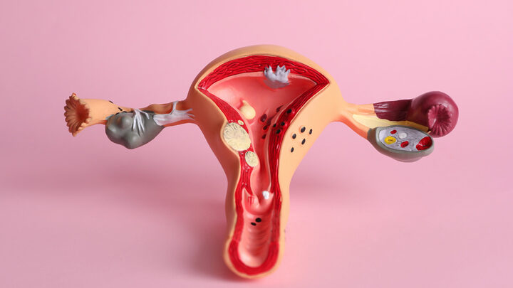 Menopausa precoce pode estar associada a variante genética rara, mostra pesquisa