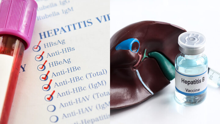 Diagnóstico precoce de hepatites virais é chave para evitar cirrose em Santa Catarina 