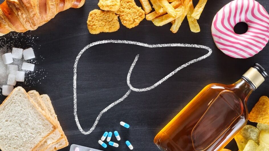 A esteatose hepática ocorre quando o fígado acumula gordura, podendo causar inflamação e graves complicações (Imagem: Evan Lorne | Shutterstock)