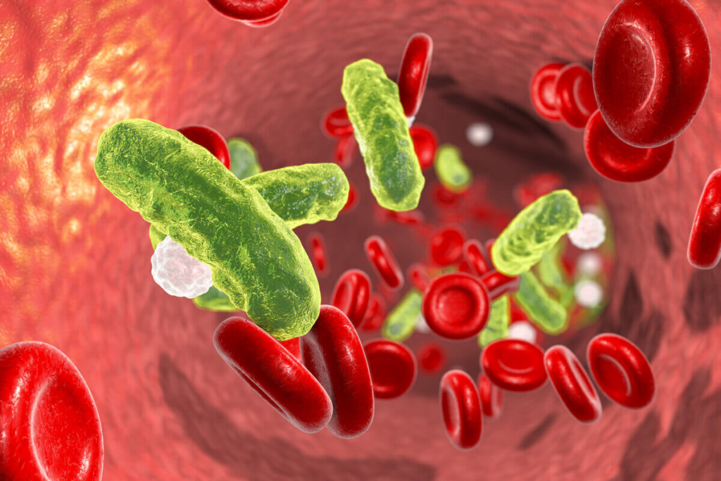 O diagnóstico precoce da sepse é essencial para aumentar as chances de sobrevivência (Imagem: Kateryna Kon | Shutterstock)