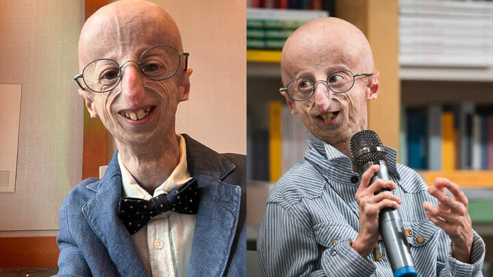 Morre aos 28 anos Sammy Basso, o “Benjamin Button da vida real”