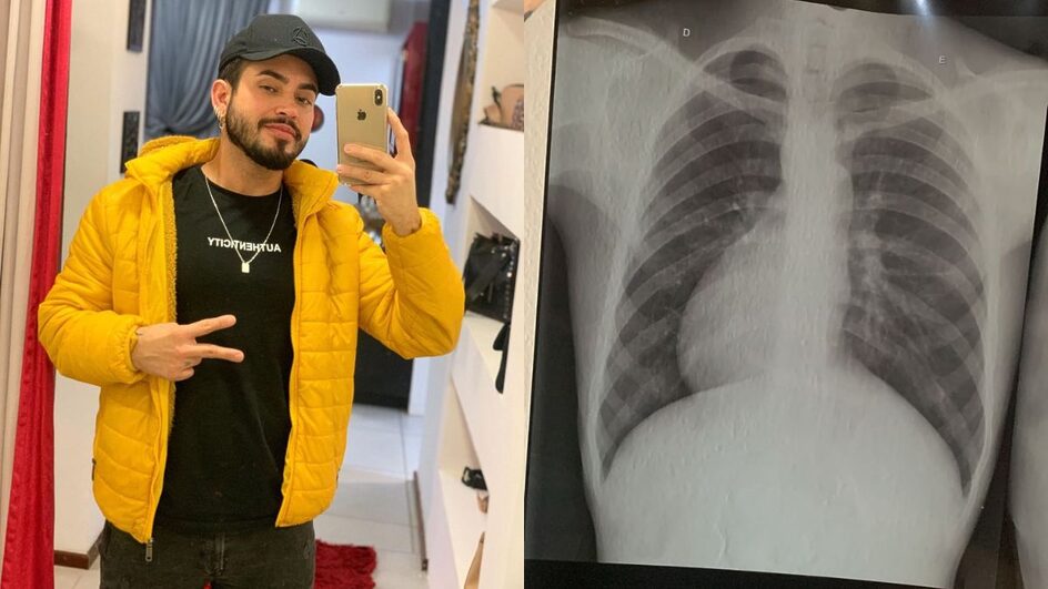 Jonas possui Situs Inversus Totalis (Foto: Arquivo pessoal)