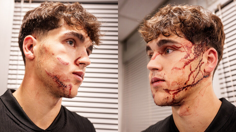 VÍDEO Zagueiro do Barcelona leva 10 pontos após chute no rosto