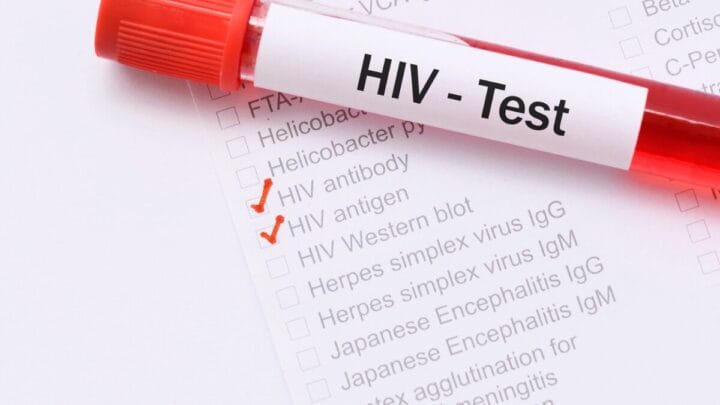 HIV