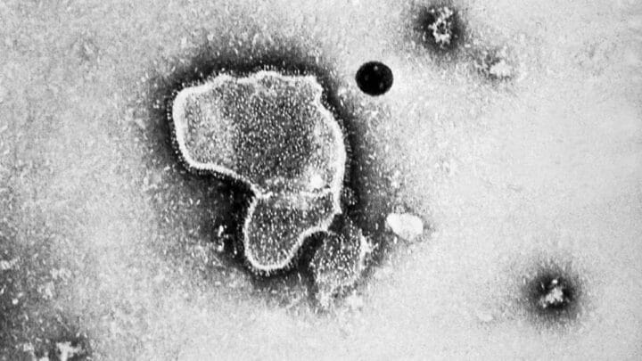 HMPV Surto de doença viral em crianças da China acende alerta cinco anos após Covid-19