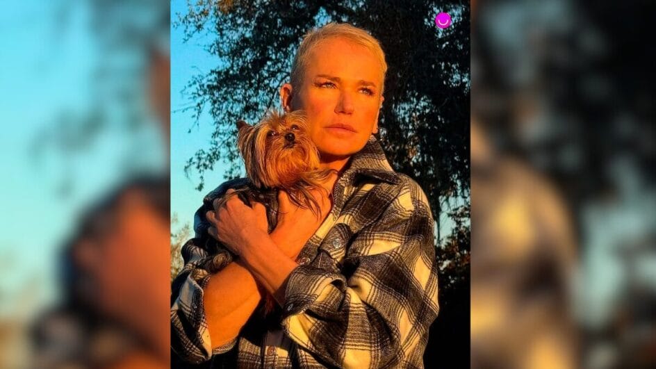 Xuxa revela que foi diagnosticada com alopecia androgenética e diz querer raspar a cabeça