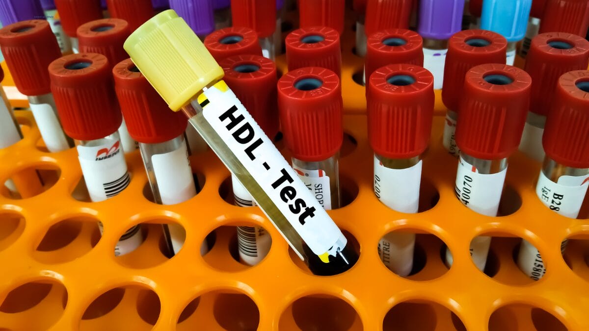 Colesterol HDL o que é e por que ele é essencial para a saúde do coração