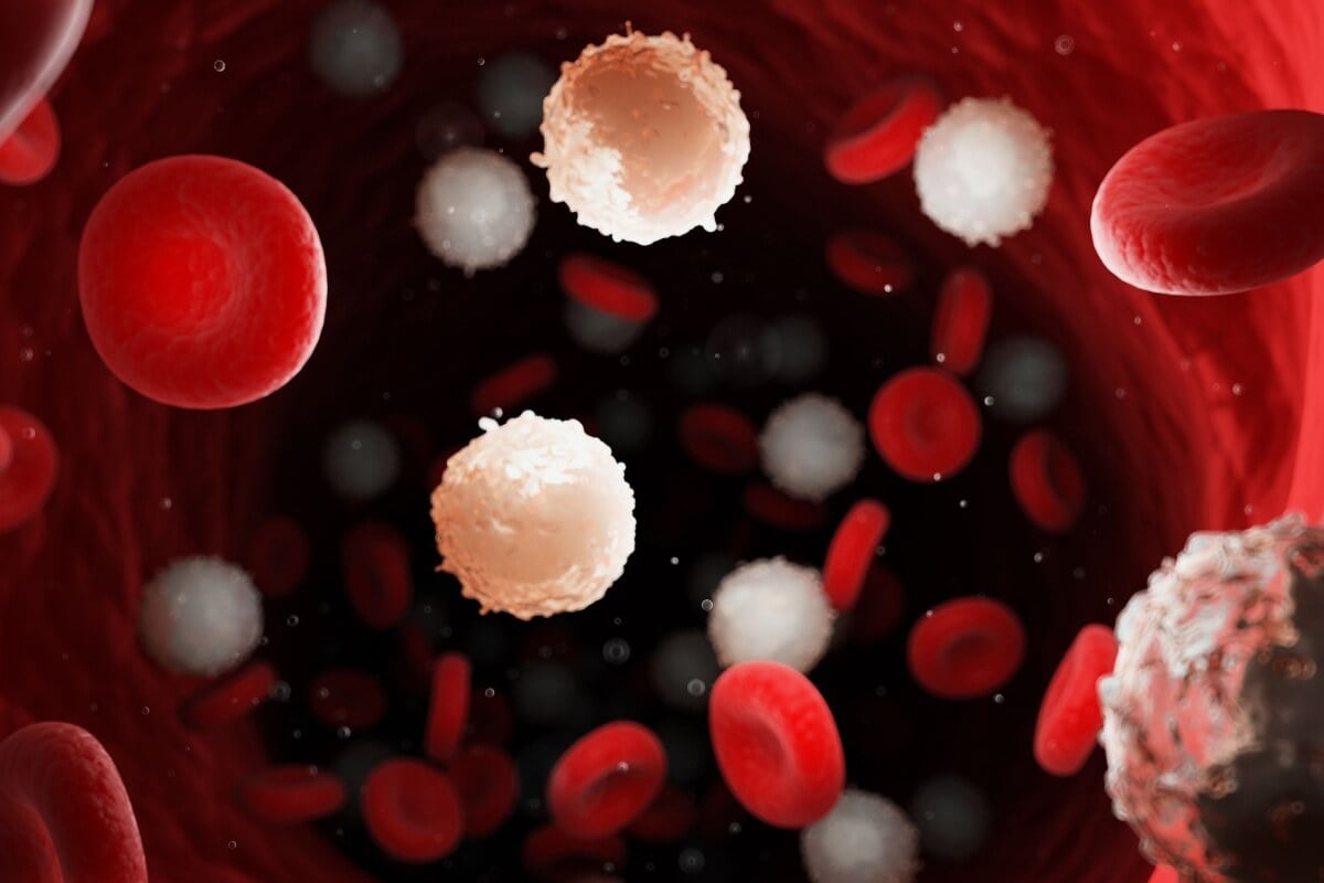 A leucemia é um câncer comum (Imagem: 3dMediSphere | Shutterstock)