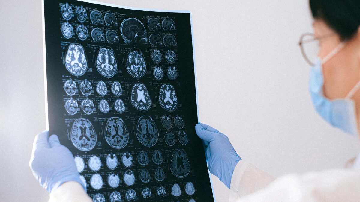 Alzheimer saiba quando o remédio que retarda o avanço da doença deve chegar no Brasil