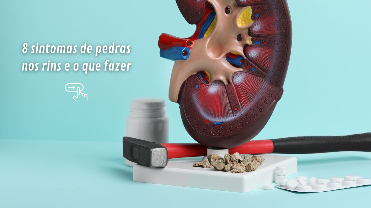 8 sintomas de pedras nos rins e o que fazer