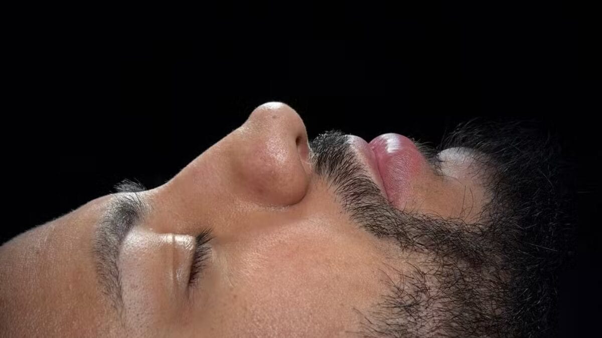 Antes da cirurgia (Foto: Reprodução, Instagram)